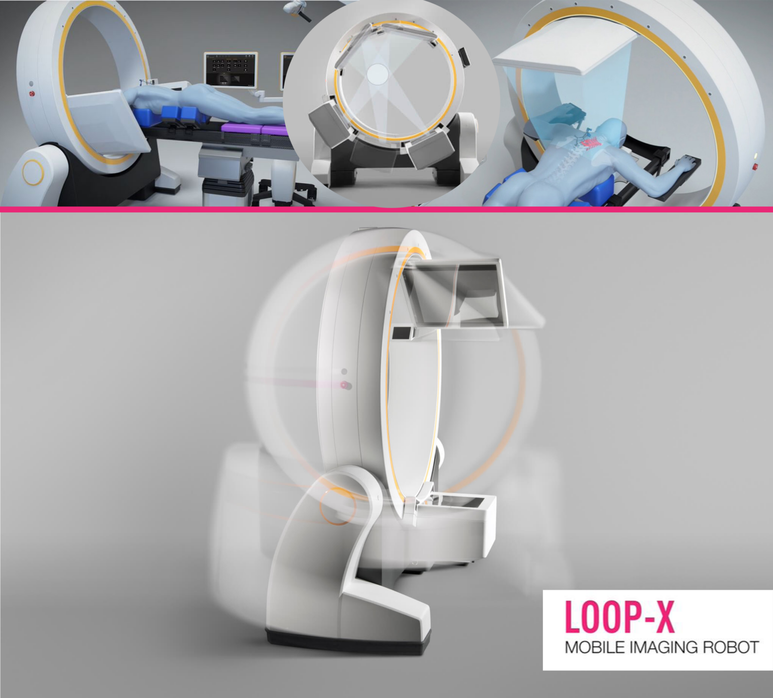 Loop X Transforma la cirugía de columna mediante la adquisición